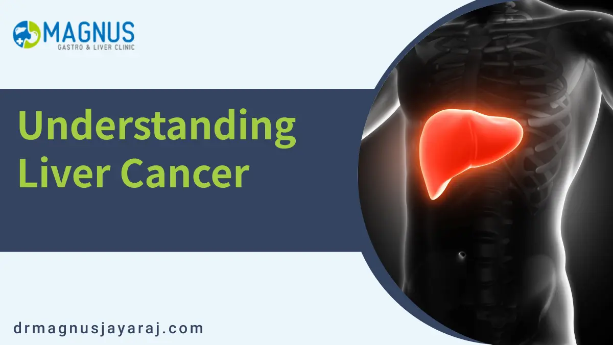 liver cancer treatment in chennai | Dr. Magnus Jayaraj