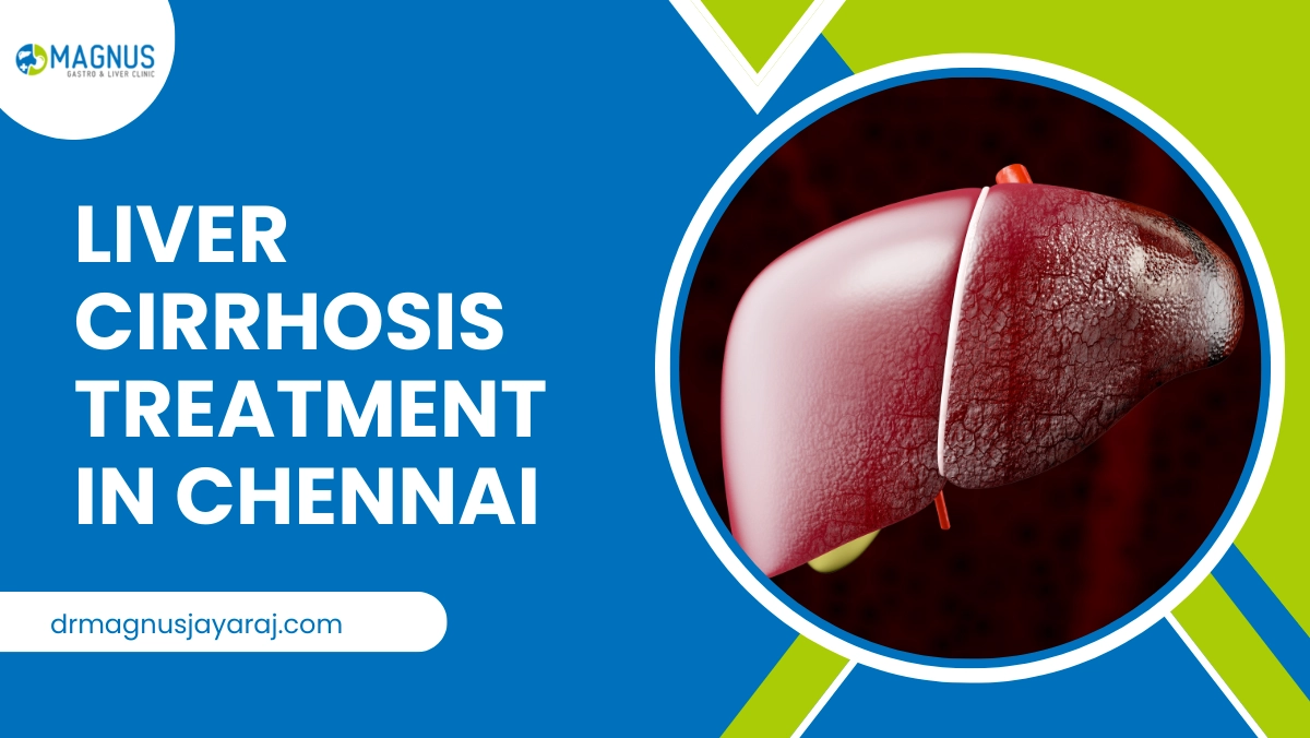 Liver Cirrhosis Treatment In Chennai