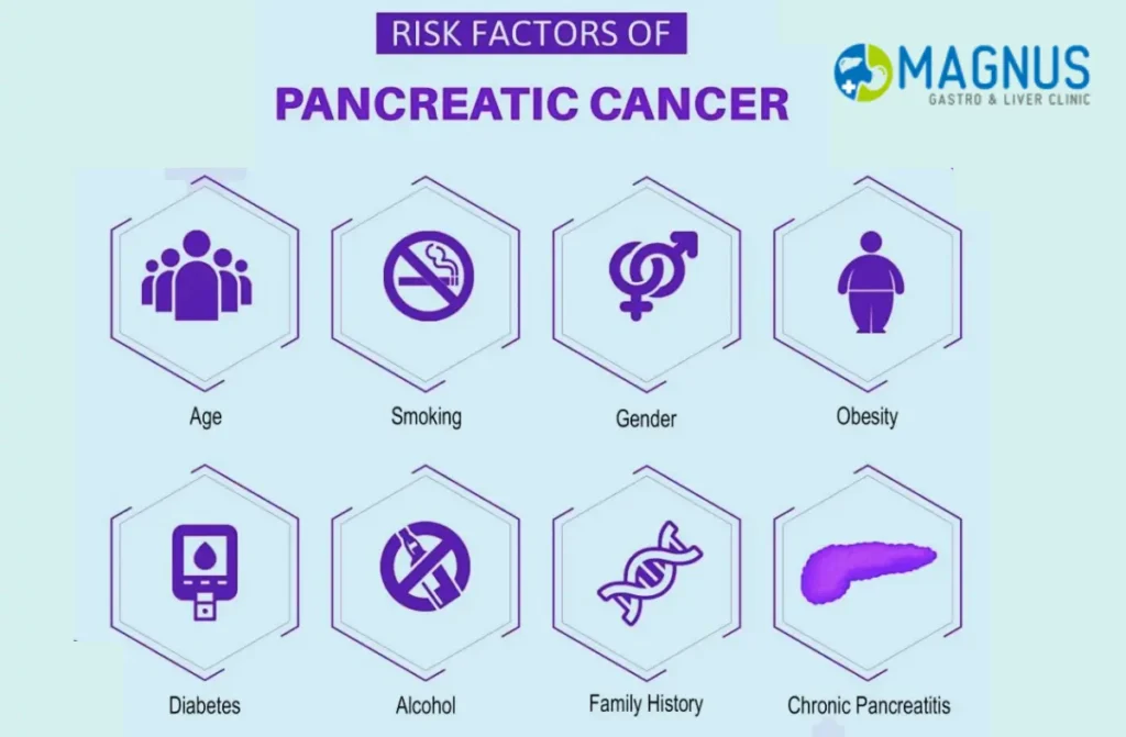 Pancreatic Cancer Survival Rate