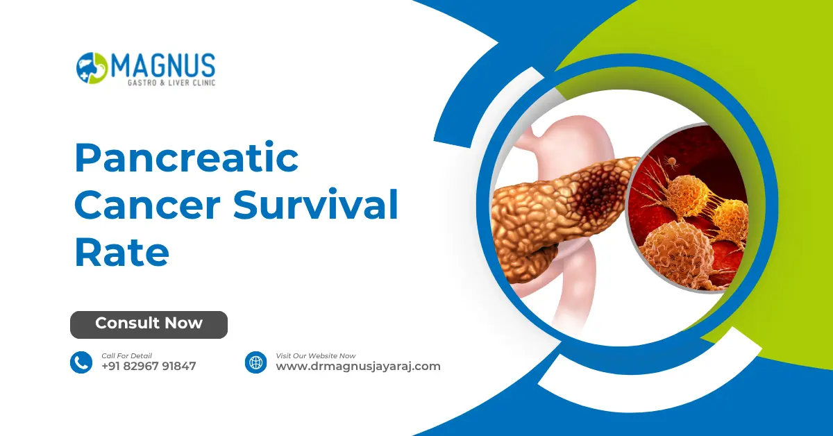 Pancreatic Cancer Survival Rate