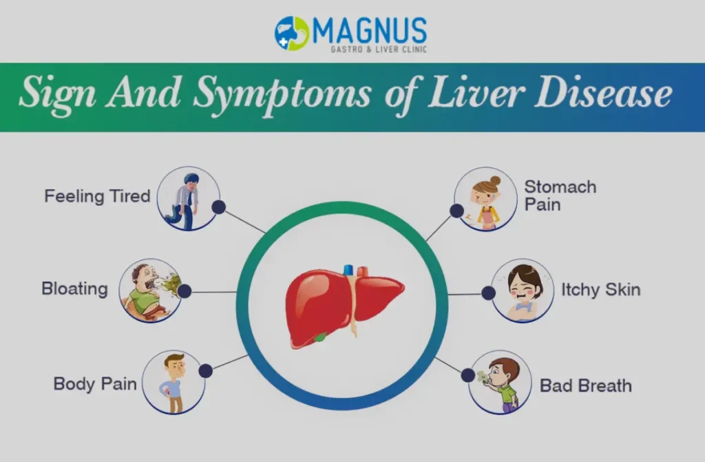 Best Acute Liver Treatment in Chennai