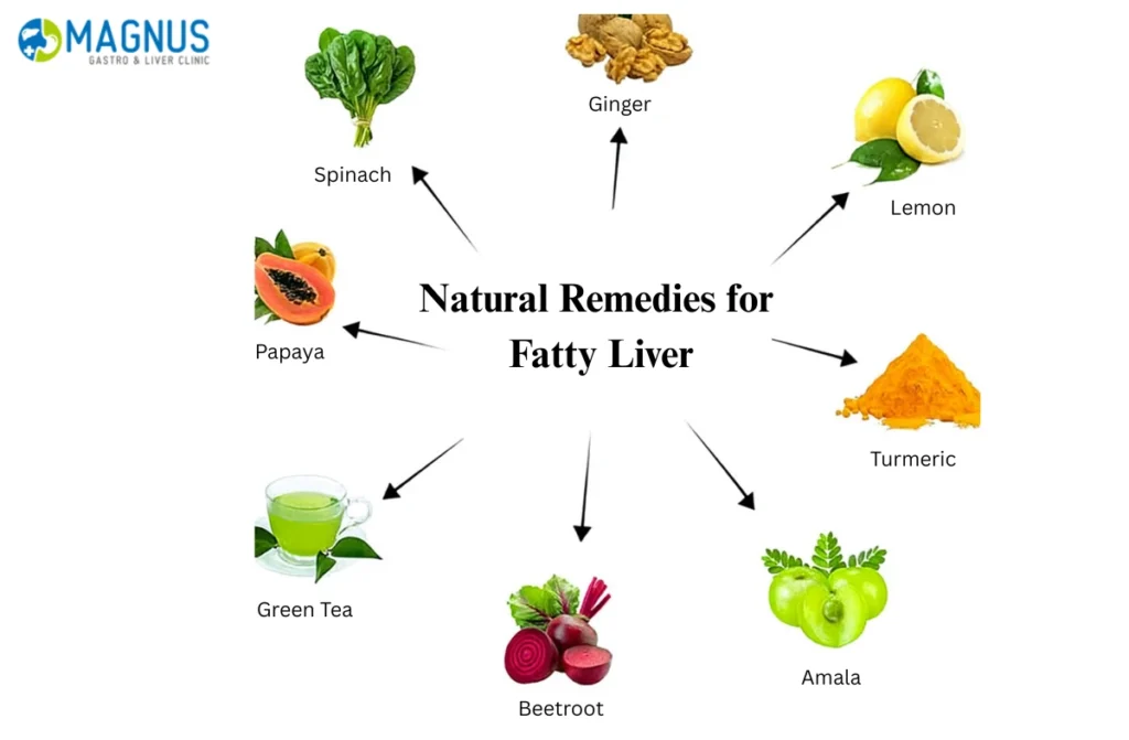 Natural Remedies for Fatty Liver 