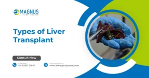 Types of Liver Transplant