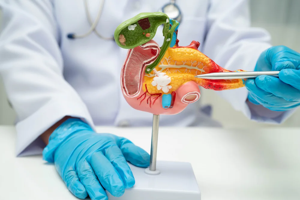 Pancreas Surgery in Chennai