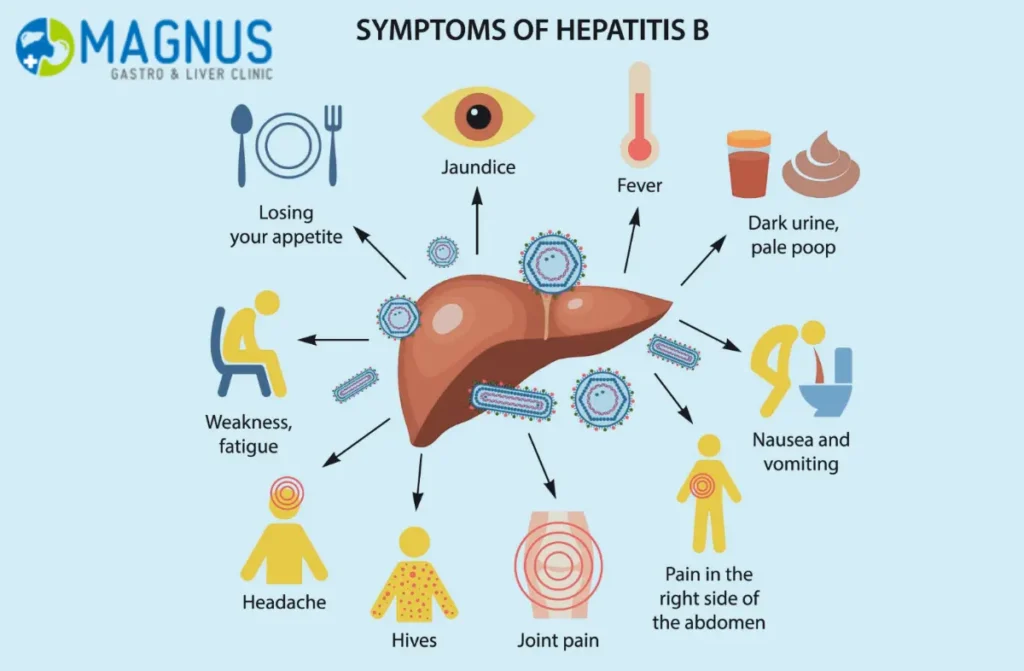 Best Treatment For Hepatitis B In Chennai