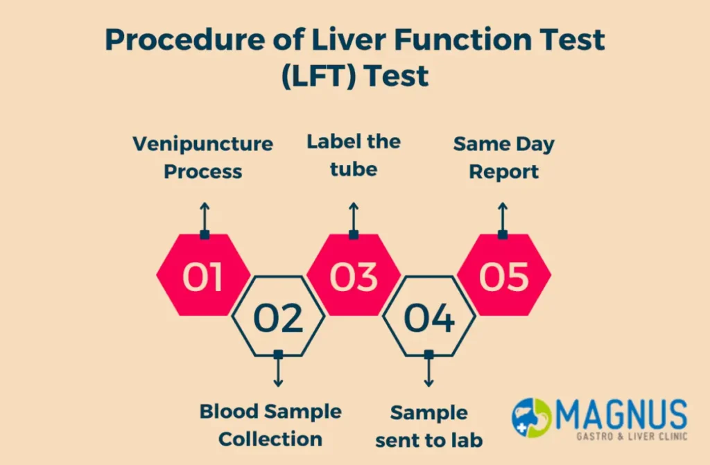 Liver Function Test in Chennai