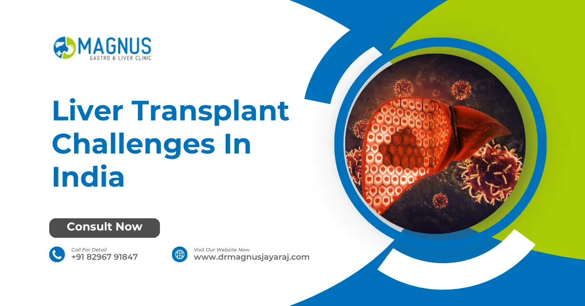Liver Transplant Challenges In India