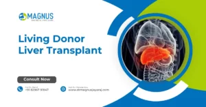 Living Donor Liver Transplant