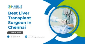 Best Liver Transplant Surgeon in Chennai