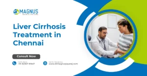 Liver Cirrhosis Treatment in Chennai