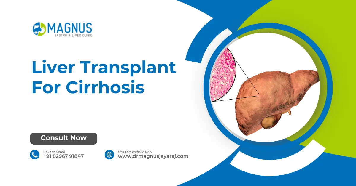 Liver Transplant For Cirrhosis