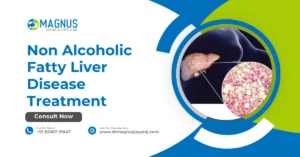 Non Alcoholic Fatty Liver Disease Treatment