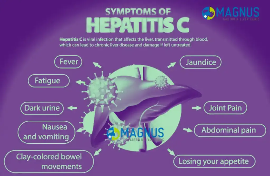 Hepatitis C And Liver Transplant