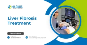 Liver Fibrosis Treatment
