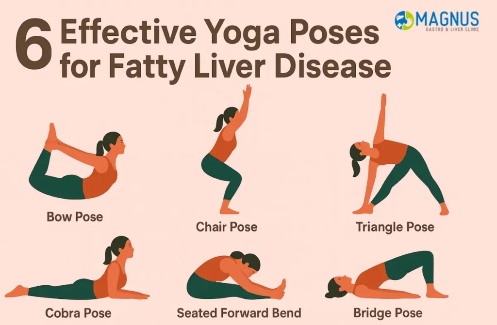 Yoga for Fatty Liver
