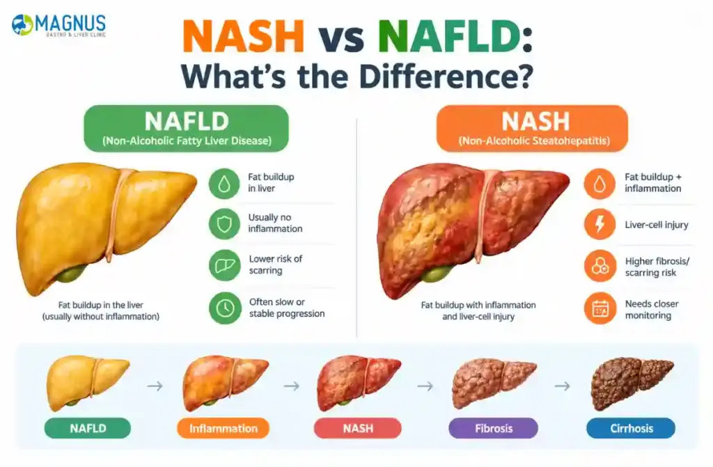 NASH vs NAFLD