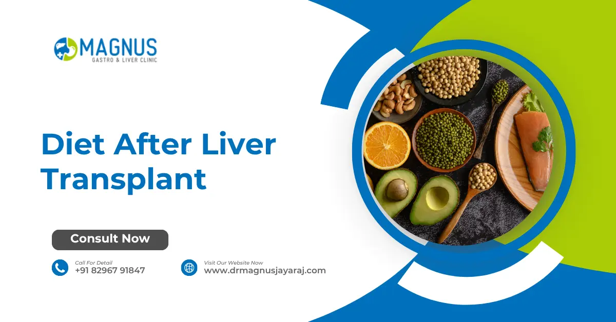 Diet After Liver Transplant