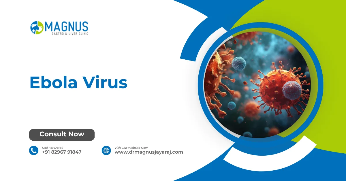 Ebola Virus