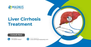 Liver Cirrhosis Treatment