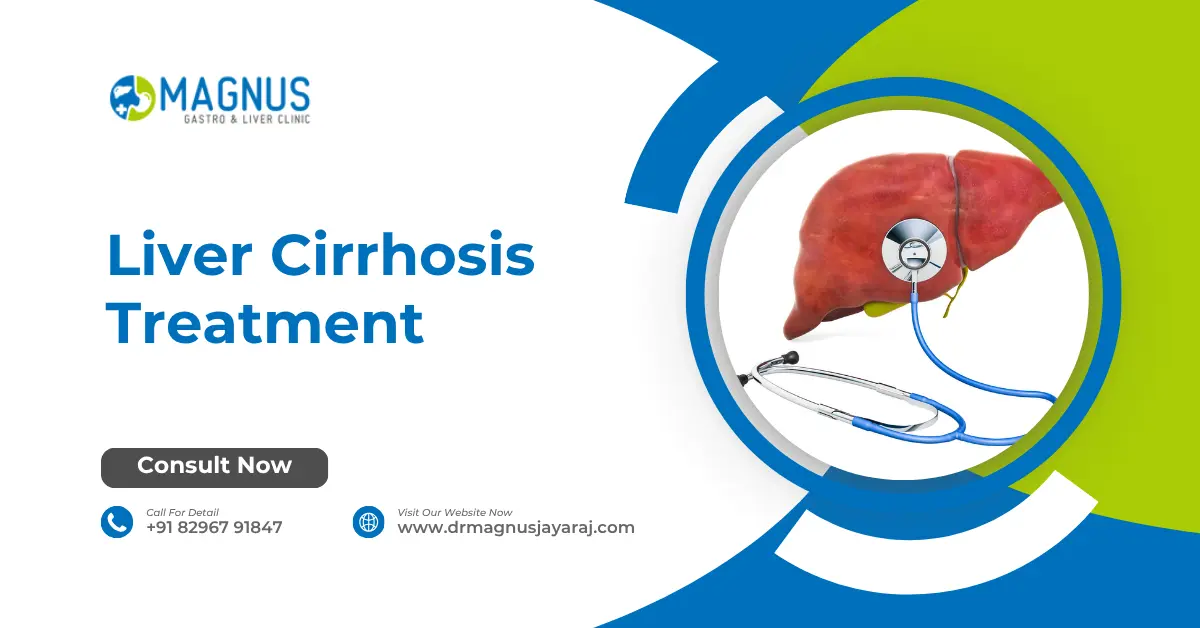 Liver Cirrhosis Treatment