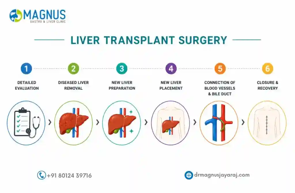 Best Liver Transplant Surgeon in Navalur
