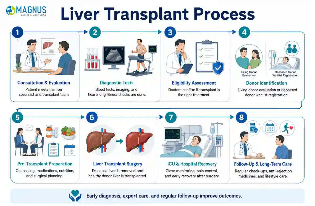Liver Transplant in chennai