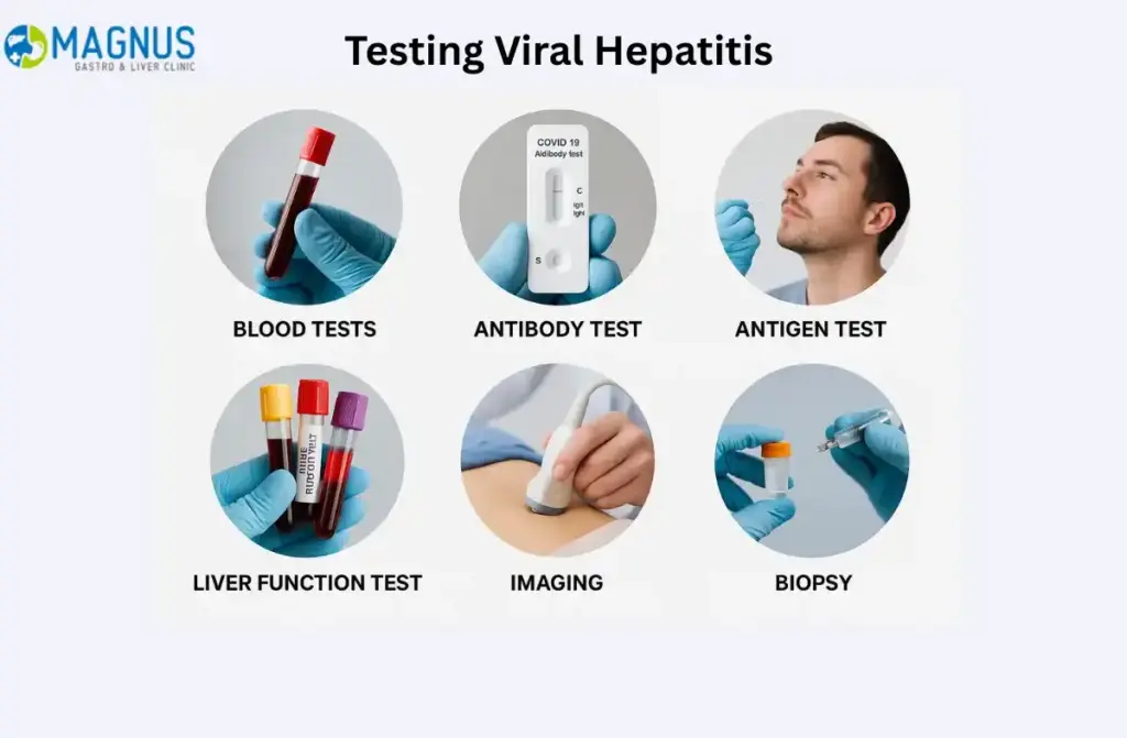 testing for viral hepatitis