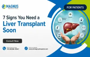 Liver Transplants