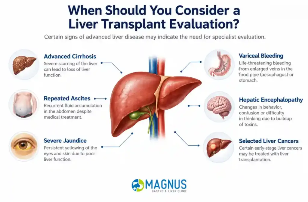 Liver Transplant Surgeon in Chennai