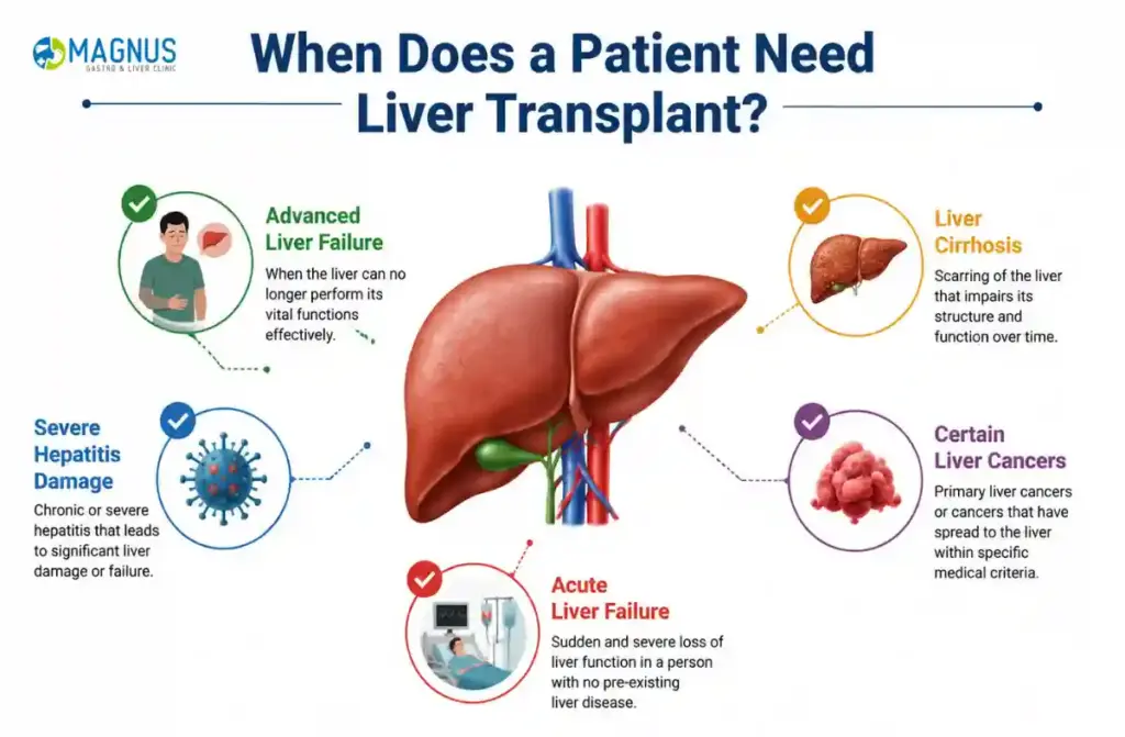Liver Transplant Surgeon in Tamil Nadu